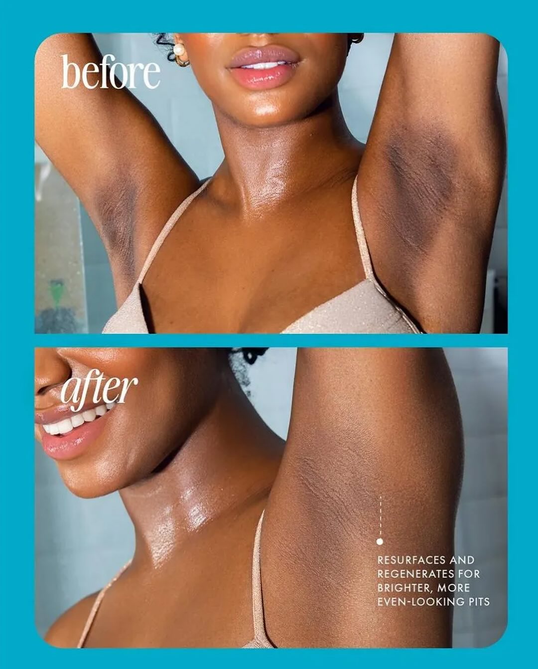 100 - TRULY JELLY BOOSTER PIGMEN TREATMEN 50ML